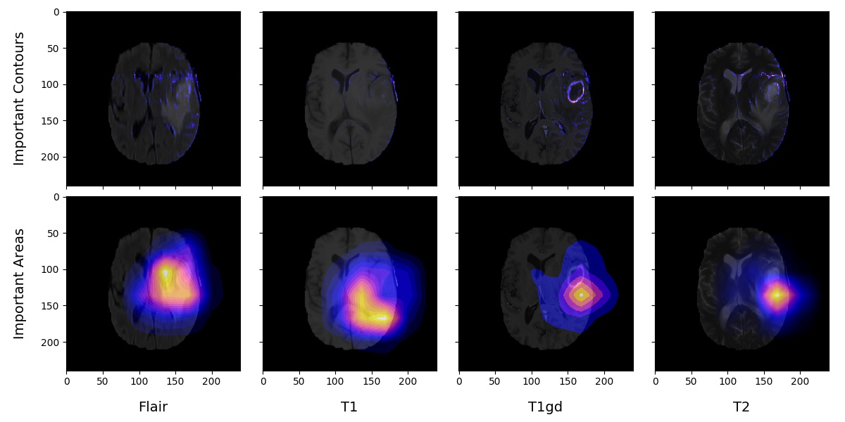 Tumor Segmentation Interpretability: Importance