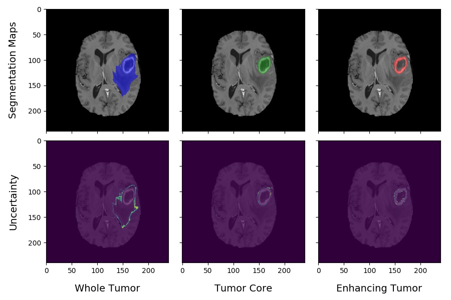 Tumor Segmentation Interpretability: Uncertainty