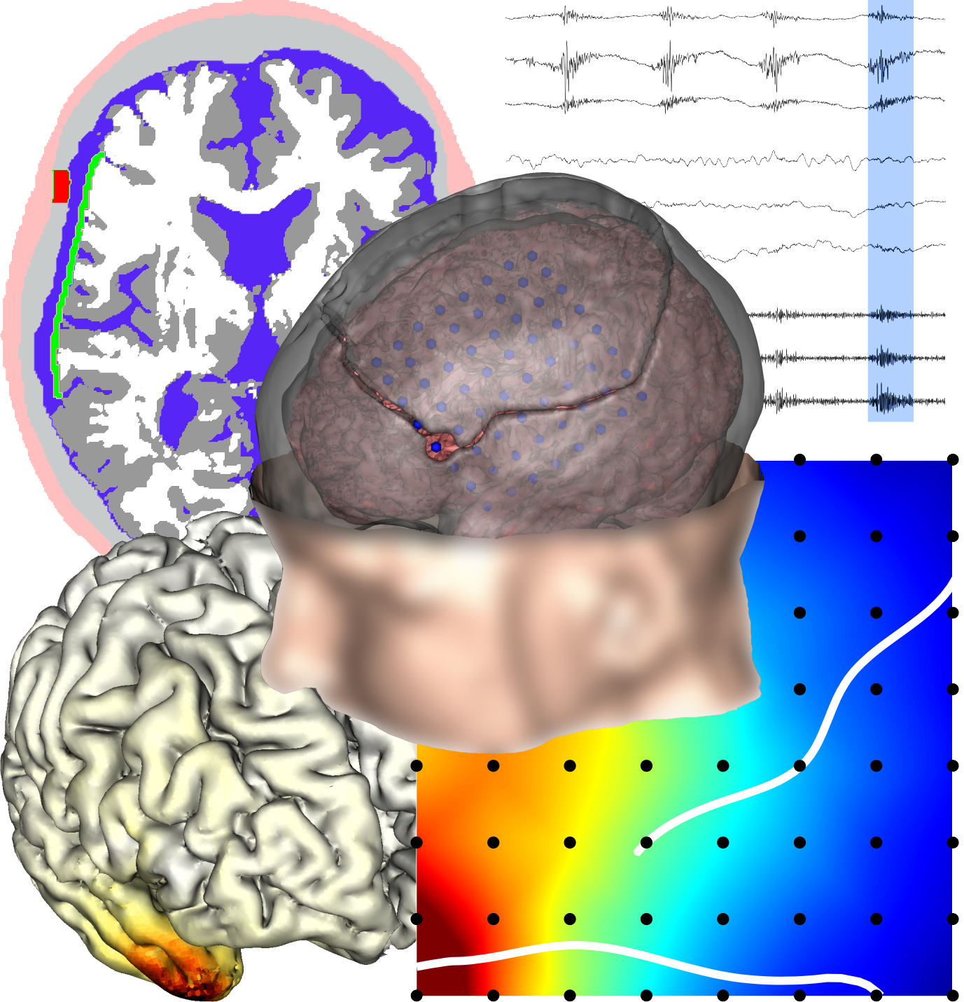 Article accepted for publication: TBME