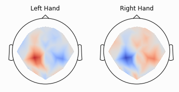 Braindecode: Deep learning toolbox for EEG