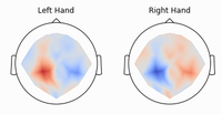 Braindecode Deep Learning Toolbox For Eeg Neuromedical Ai Lab